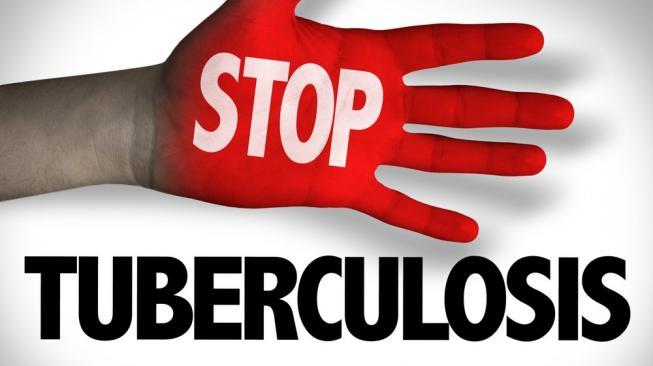 Mewabahnya Covid-19, Kasus TBC di Indonesia Terabaikan